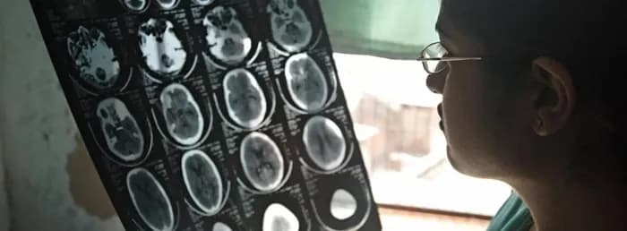 WHO: Bệnh lý thần kinh gây hơn 11 triệu ca tử vong mỗi năm